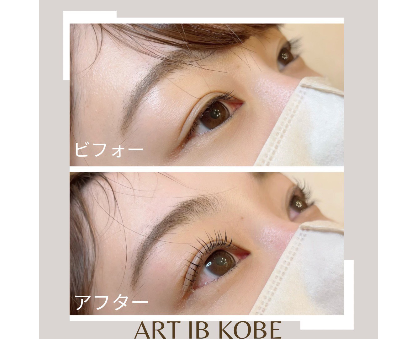 ビフォーアフター