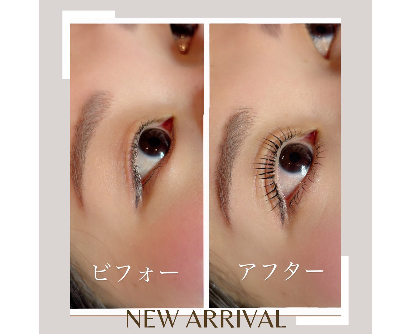 ビフォーアフター
